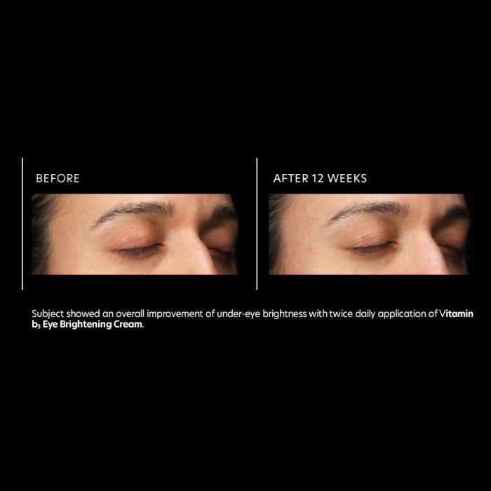 Vitamin B3 Eye Brightening Cream