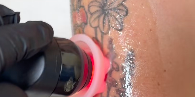 Refresh Your Tattoos with Body Glo2Facial