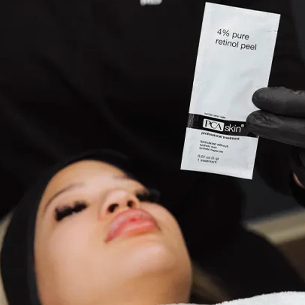 PCA 4% Retinol Peel | Columbia, SC