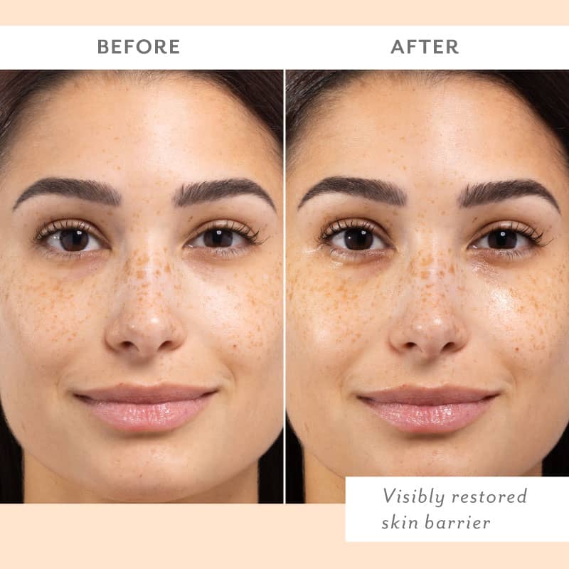 Skin Remedy Calm &amp; Protect Micro Mist