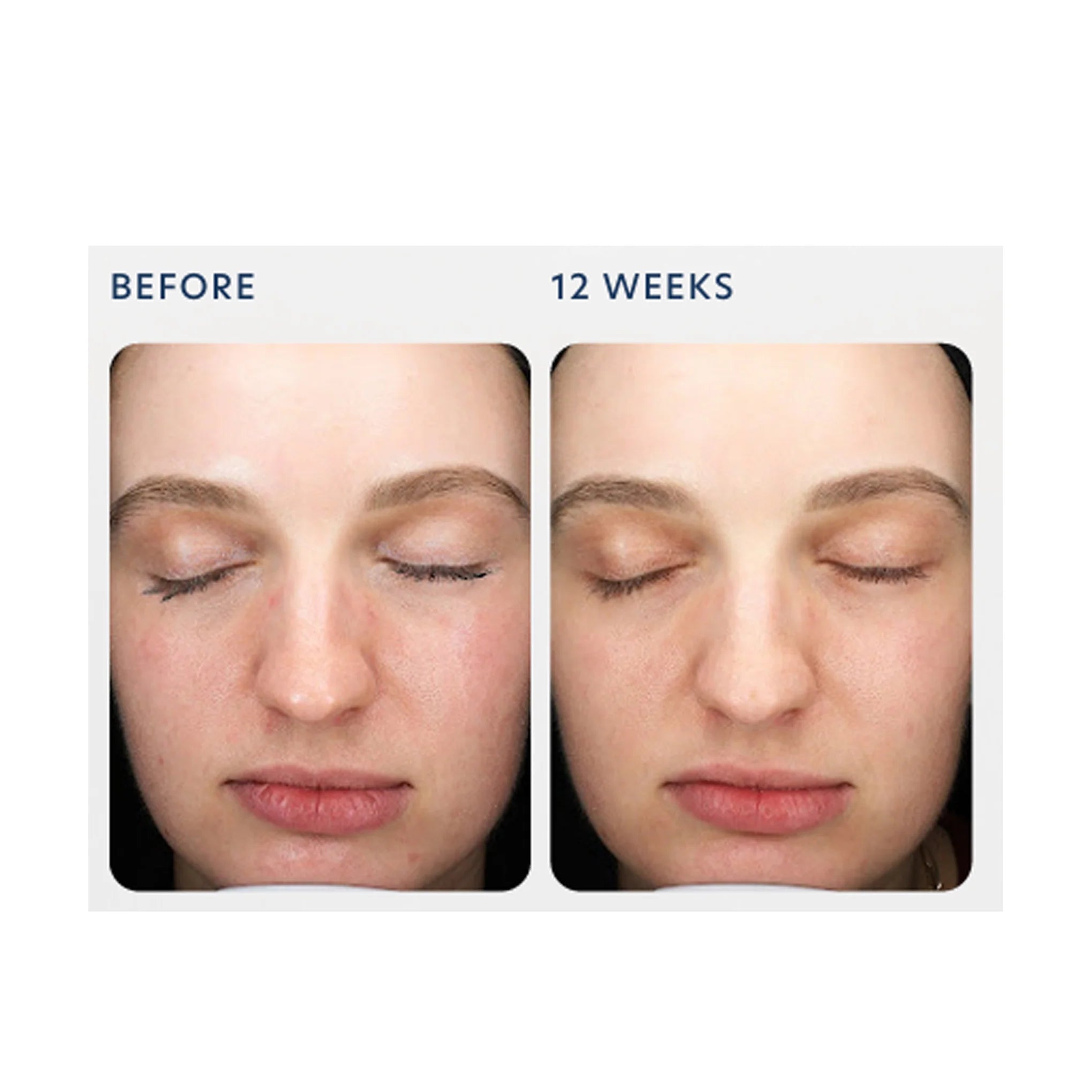 Triple Exfoliation Peel Pads