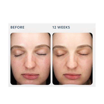 Triple Exfoliation Peel Pads