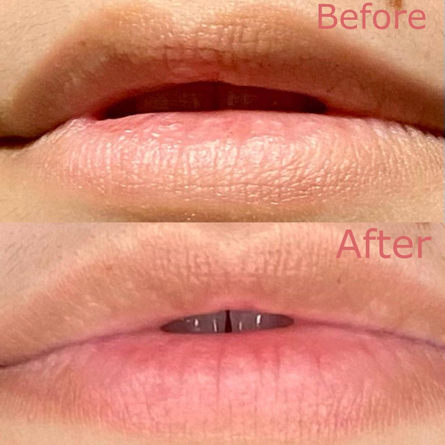 Serve Chilled™ Rosé Lip Gels